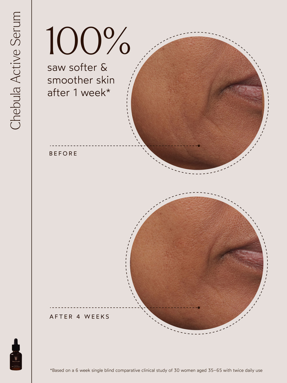 Before-and-after close-ups showing improved skin texture after 4 weeks of using True Botanicals Chebula Active Serum. The image highlights a visible reduction in roughness and fine lines, with text noting that 100% of users reported softer, smoother skin after just 1 week, based on a clinical study of 30 women aged 35–65.
