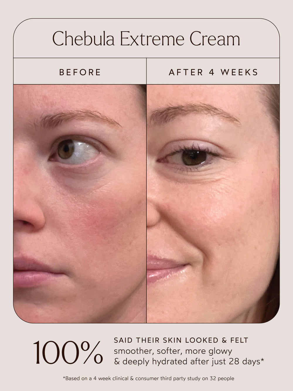 Before-and-after comparison showing visible skin improvement after 4 weeks of using True Botanicals Chebula Extreme Cream. The left image shows dryness and fine lines under the eye, while the right image reveals smoother, more hydrated, and radiant skin. Text states that 100% of users said their skin looked and felt smoother, softer, more glowy, and deeply hydrated after 28 days, based on a third-party study of 32 people.