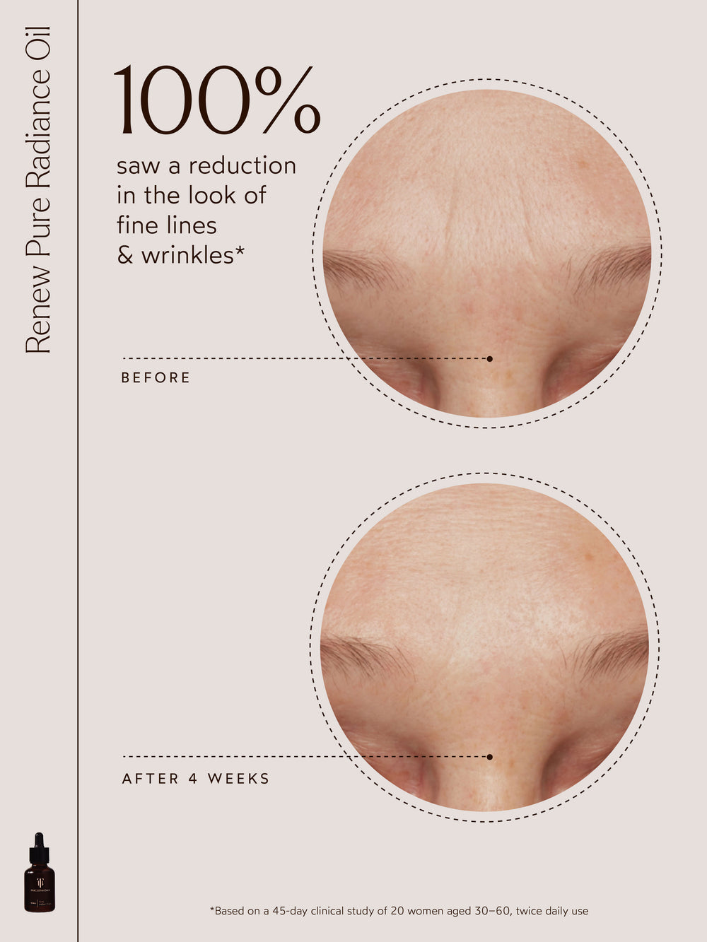 An image displaying "100% saw a reduction in the look of fine lines & wrinkles*" with detailed before-and-after visuals focused on forehead lines. It features the Renew Pure Radiance Oil bottle and notes findings from a 45-day clinical study involving 20 women aged 30–60, using the product twice daily.
