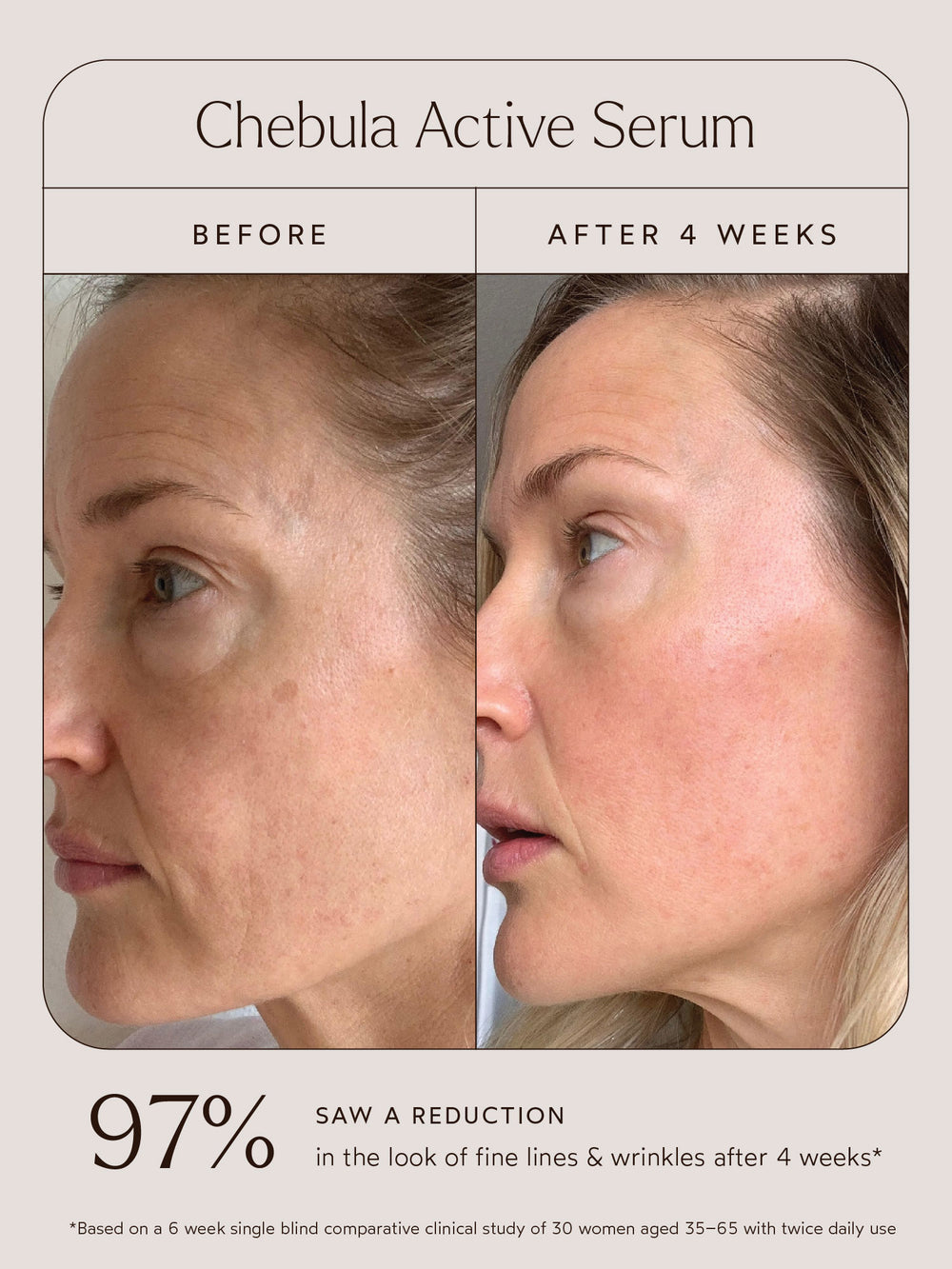 Before and after images showing the effects of Chebula Active Serum. The "After 4 weeks" image reveals smoother skin with reduced fine lines and wrinkles. Study shows 97% saw improvement after 4 weeks.