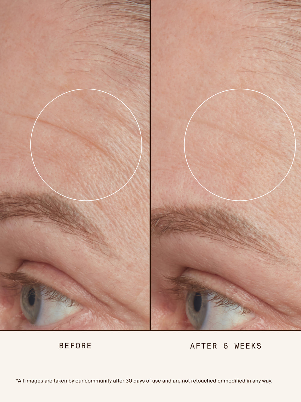 Phyto-Retinol Clinical Serum